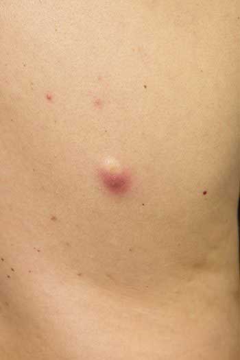 smhgmatogonos kysth2