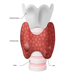 karkinos-thyroeidous2