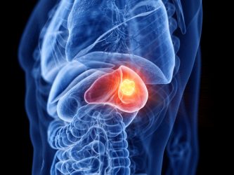 neoplasmata splinos1