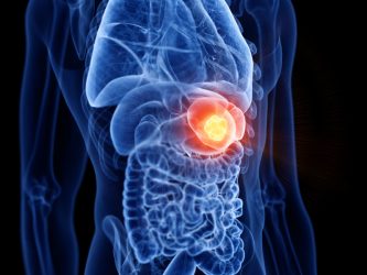 neoplasmata_splinos2